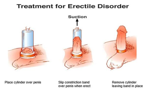 Premium Vacuum Enhancement Pump for Men